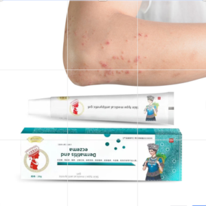 Eczema and Dermatitis Ointment 20g
